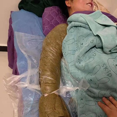 热灸膏使用案例