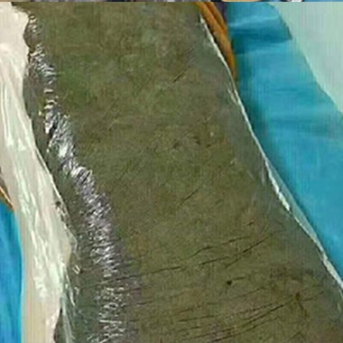 热灸膏使用案例