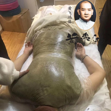 黄飞鸿热灸膏调理案例